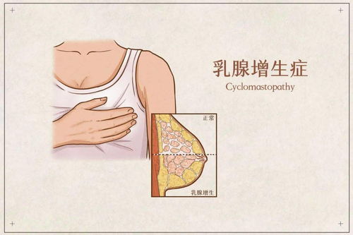 为什么要疏通乳腺结节