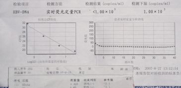 重庆乙肝治疗， 乙肝治疗哪好?