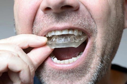 你的牙齿敏感是下面哪种情况