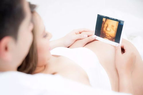 原创孕妇在孕期可能会遇到的这3种“尴尬”事，要做好心理准备