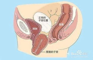 做完人流手術(shù)后需要休息多久才能站立上班？