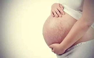 孕妇一般几个月开始长妊娠纹,怀孕几个月开始长妊娠纹？