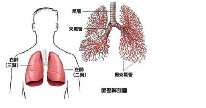 什么是肺癌(什么是肺癌根治术)