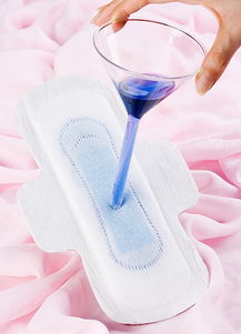 静医生备孕 卫生巾的7个错误使用习惯,容易染上妇科病