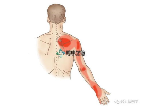 背部肩胛骨疼痛的原因 搜狗图片搜索