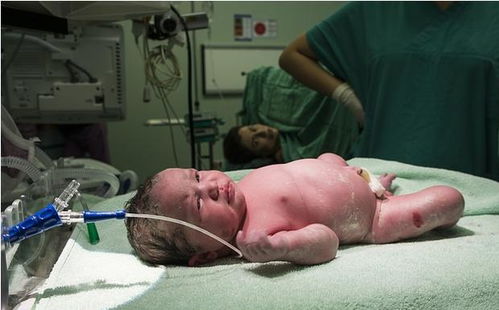 30岁孕妇生下34斤男婴,两天一罐奶粉,真的是从小赢在起跑线上