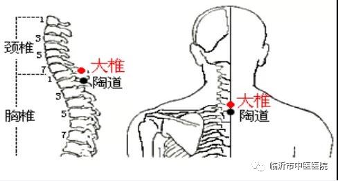 专家解读我院 2020年冬春季流感 新型冠状病毒感染的肺炎中医药预防方案 及注意事项 一