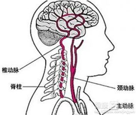 脑供血不足老感觉眼前有异物怎么办