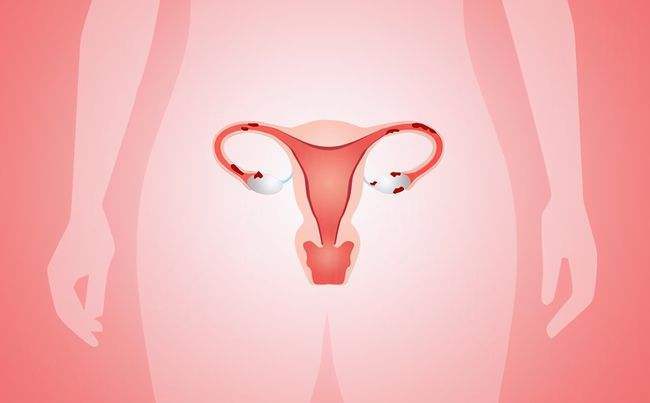 宫茹清科普 女人月经量过少就代表着卵巢功能不太好吗