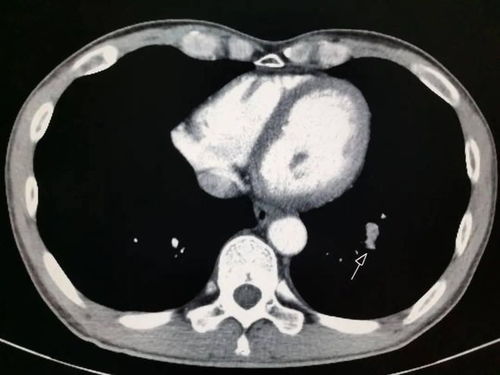 照一次CT,对人体有伤害吗 终于有医生肯站出来说实话了