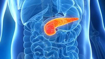 胰腺癌晚期转肝黄疸,胰腺癌出现黄疸怎么办？