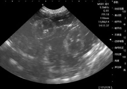 怀孕四个月男胎儿图，这是4个月的b超单,请大家帮你看看是男孩还是女孩,谢了
