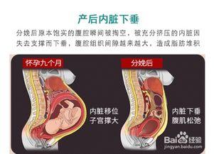 收腹带和束腹带 绑腹带的区别,哪种腹带效果好 