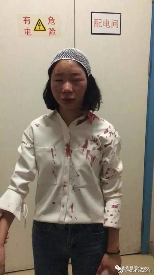 丧心病狂 女大学生昆明旅游莫名遭摩托男暴打,血浸透衣服,头部缝6针 