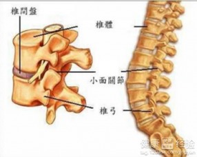 椎间盘退行性变怎么诊断