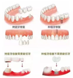 她掉了颗牙没当回事,结果 