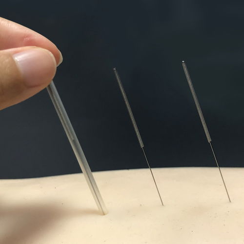 激光焊接 智象针灸针 500支装带管 一次性使用无菌针灸针医用中医针灸用品