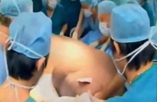 10名医生为大肚孕妇接生,剖腹产生出了11个宝宝