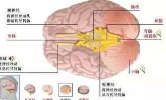 脑萎缩症状有哪些