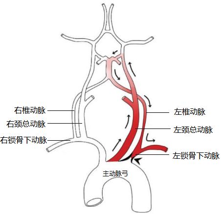 热成像可以检查血管堵塞吗