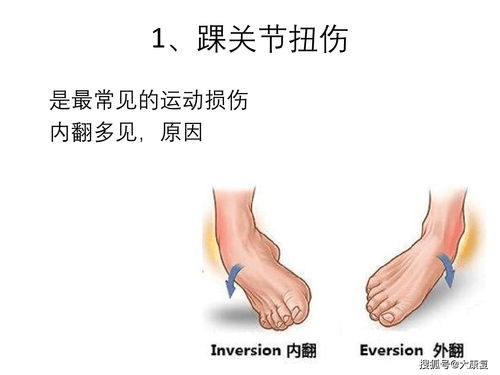 常见的运动损伤有哪些