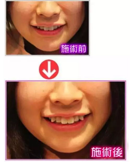 这是两颗改变命运的牙齿,你有吗 