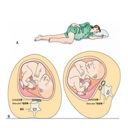 原创孕期监测胎动很重要准妈妈应该怎么数胎动