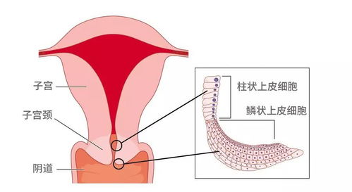 我想去看宫颈糜烂。。合肥军大的董明菊医生怎么样啊？

补充：我之前听周围邻居说，合肥军大的董明菊医生不错，以前还是个上海那边的专家。。
是这么个说法吗？怎么去比较方便