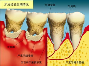 人类的牙齿为什么只能长两次 难逃掉牙的噩梦