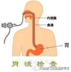 做肠镜前喝导泻药不起作用