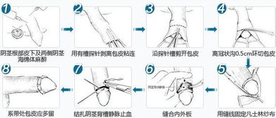 男人包皮过长有什么影响 哪几种包皮需要割掉