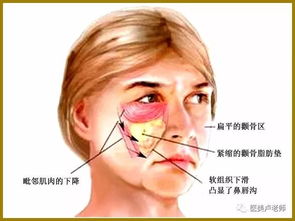 怎样选择面部提升的医疗手段 