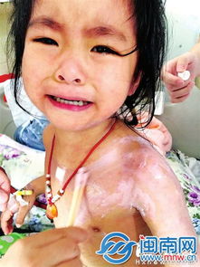 福州协和医院挂错瓶 3岁女童全身现皮疹又痛又痒
