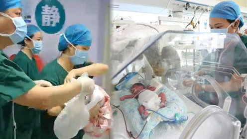 24岁产妇早产1女4男5胞胎(山东24岁产妇早产1女4男5胞胎)