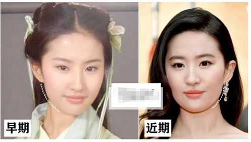 20 女明星都怕的颜值杀手 到底要怎么预防发腮以及视觉衰老