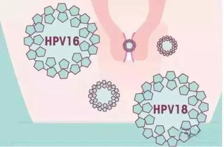 备孕期检查出HPV病毒阳性感染，对以后的孩子会有哪些影响