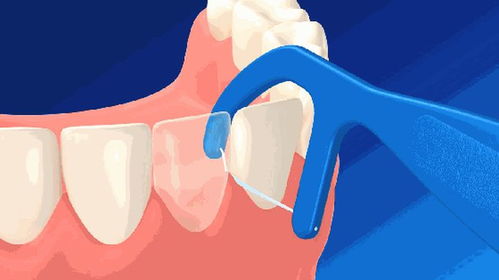 三种牙线的正确使用方法对比,你看懂了吗