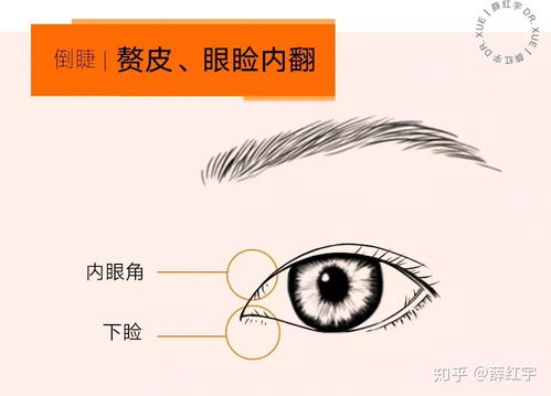 睫毛浓密 卷翘的可行性方案 