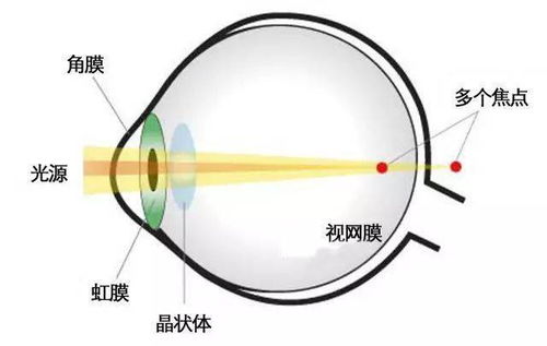 你散光了吗