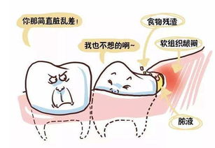 为什么智齿要拔掉呢 智齿真的一无是处吗