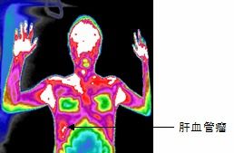 医用红外热成像仪排名