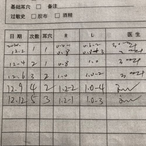 程氏针灸梅花针防治近视的效果如何