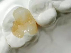 安徽 公共频道 健齿节 全城救助 丑牙 龅牙 地包天 牙齿畸形 牙齿缺失 牙黄黑 前100名