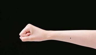 痣相分析 手臂上有痣代表着什么 