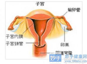 急性子宫内膜炎的病因