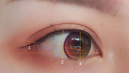 眼睛整形怎么做_眼部整形手术需要注意什么