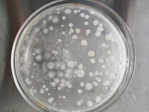 菌落总数试验 琼脂表面有很多菌落