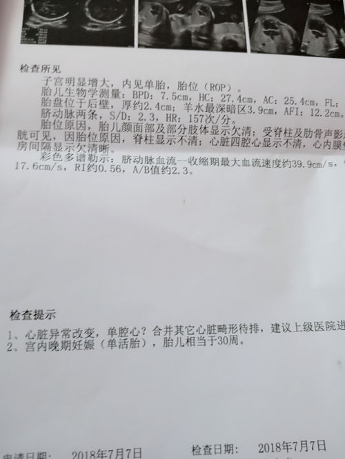 宝妈们怎么办,宝宝要不要生下来