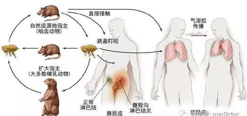 鼠疫的症状