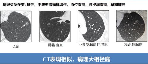 ct后脸红痒，怎么办